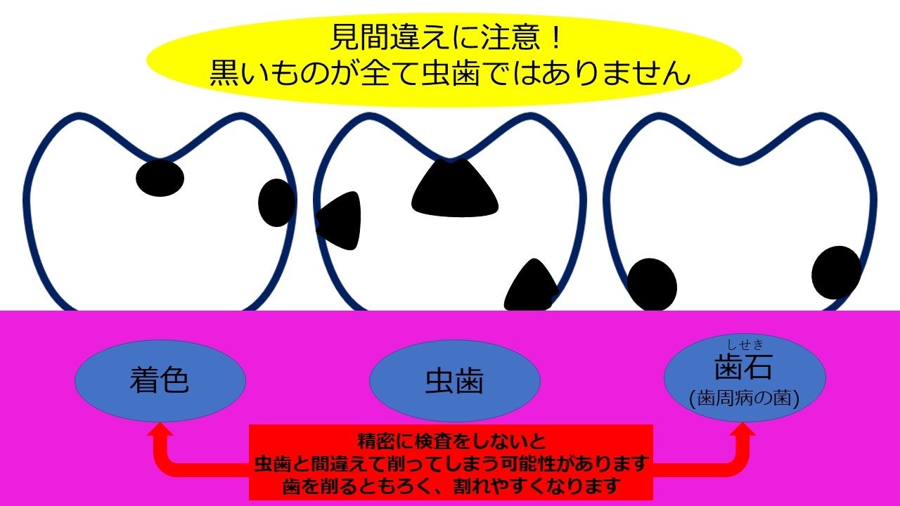 「SDGsな歯医者さん」キャンペーンをスタートのサブ画像2