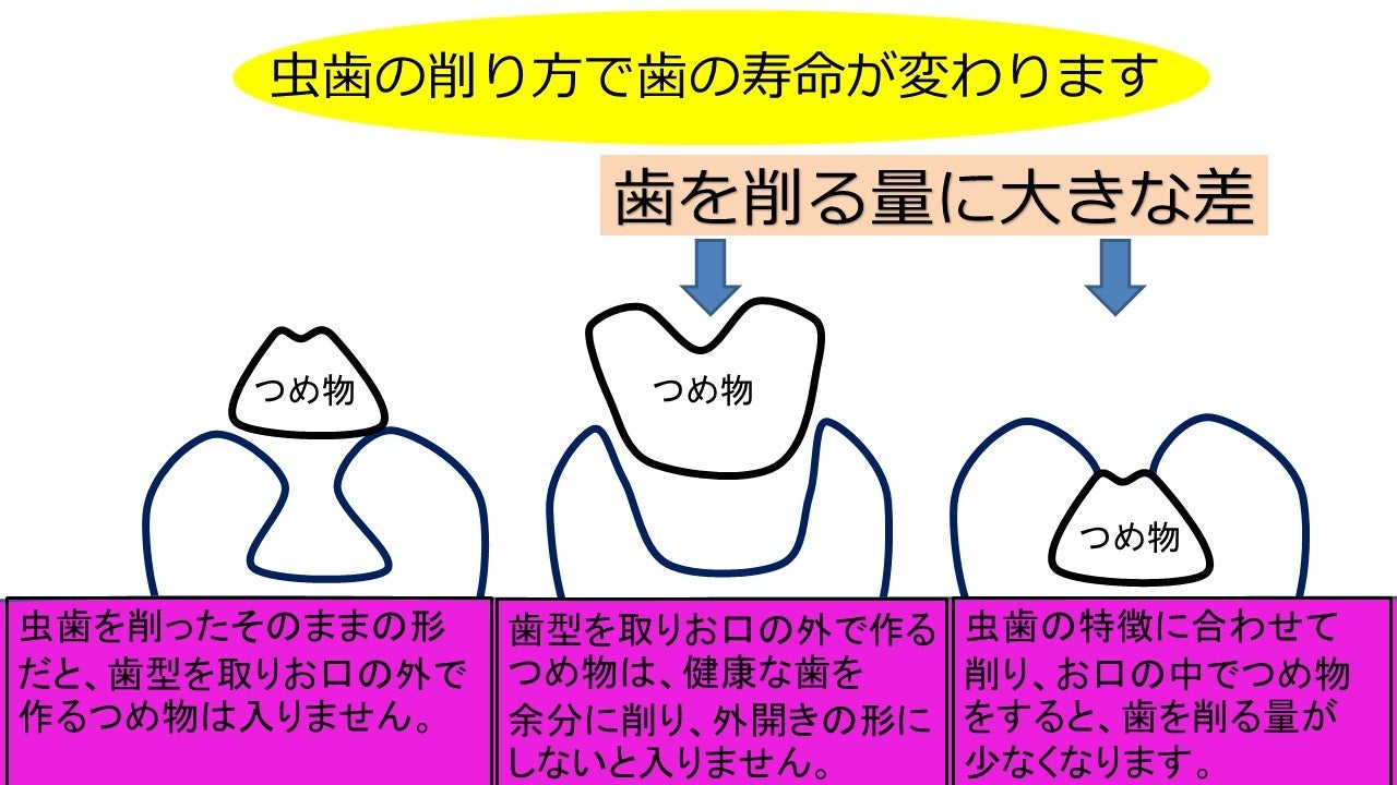 「SDGsな歯医者さん」キャンペーンをスタートのサブ画像6